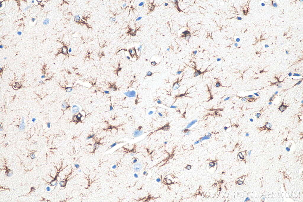 IHC staining of mouse brain using 60190-1-Ig IHC staining of mouse brain using 60190-1-Ig