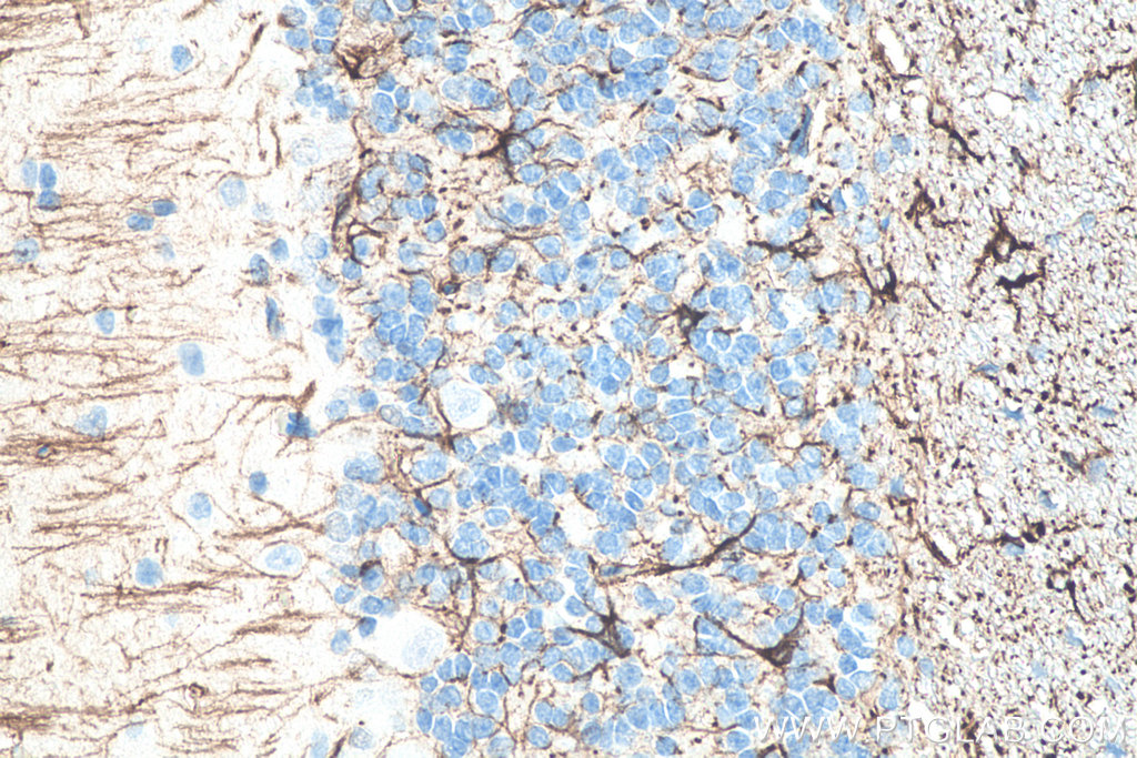 IHC staining of rat cerebellum using 60190-1-Ig IHC staining of rat cerebellum using 60190-1-Ig