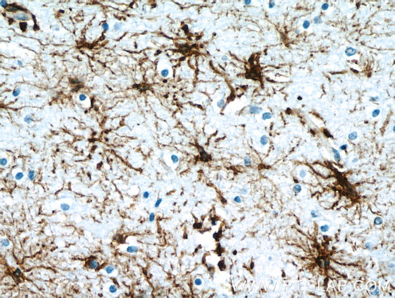 IHC staining of human brain using 60190-1-Ig