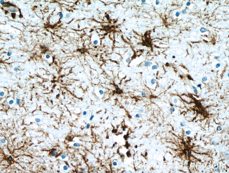 GFAP Monoclonal antibody