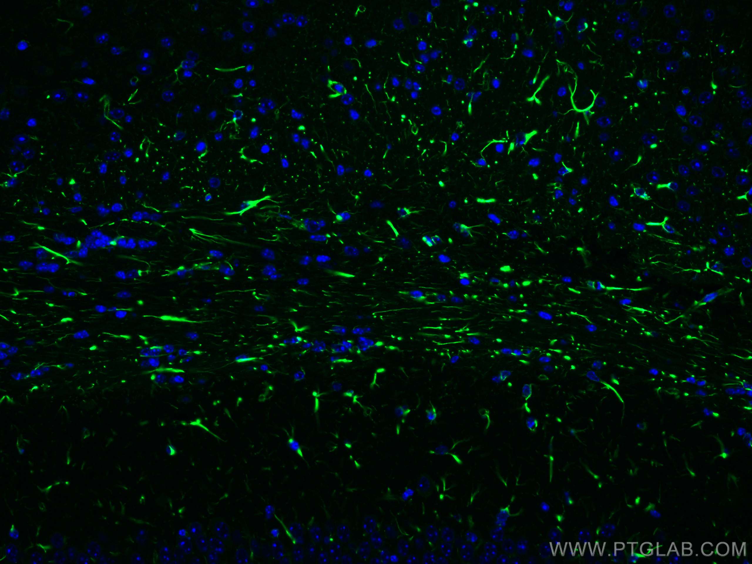 IF Staining of mouse brain using 81063-1-RR