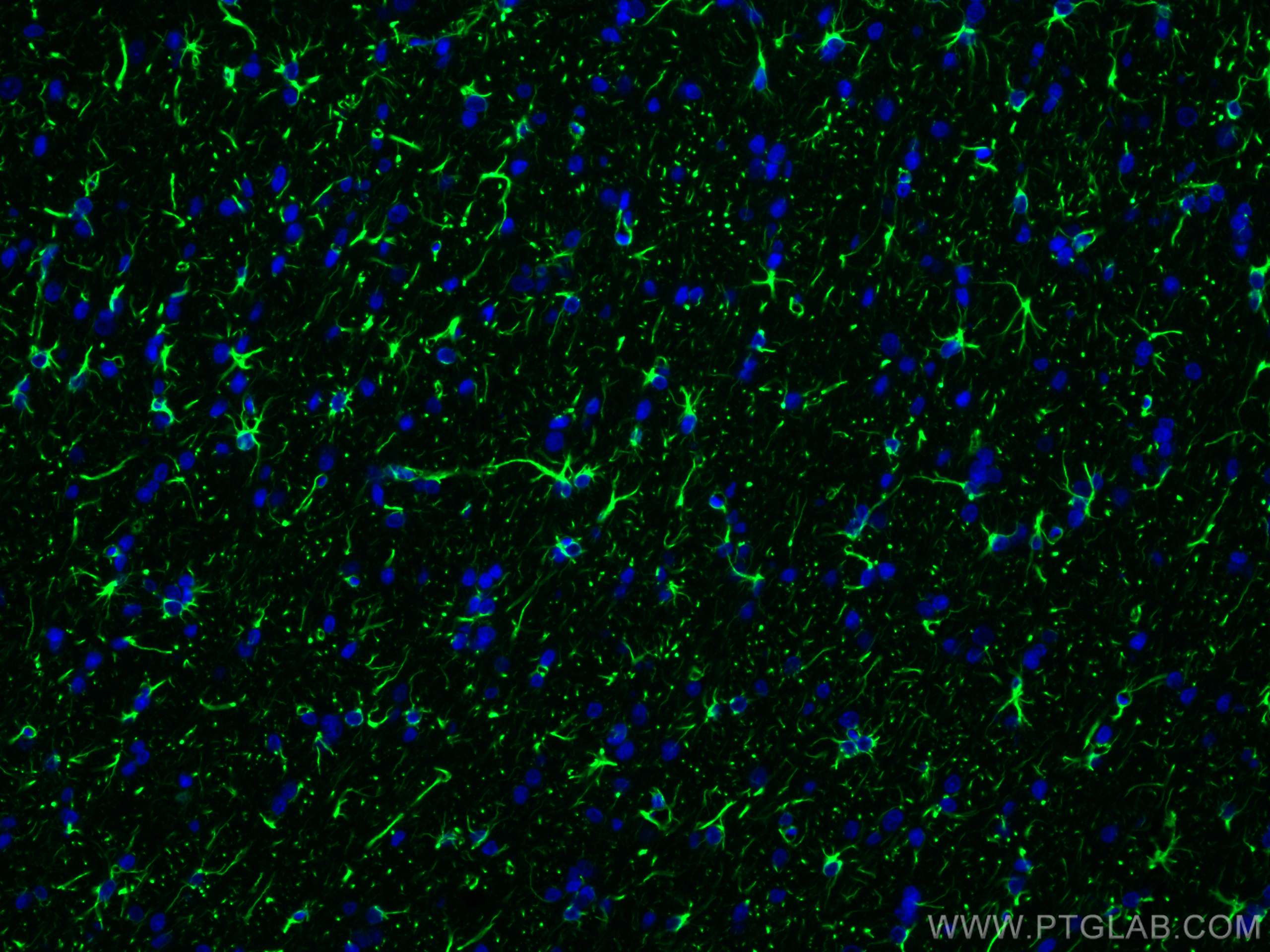 IF Staining of rat brain using 81063-1-RR