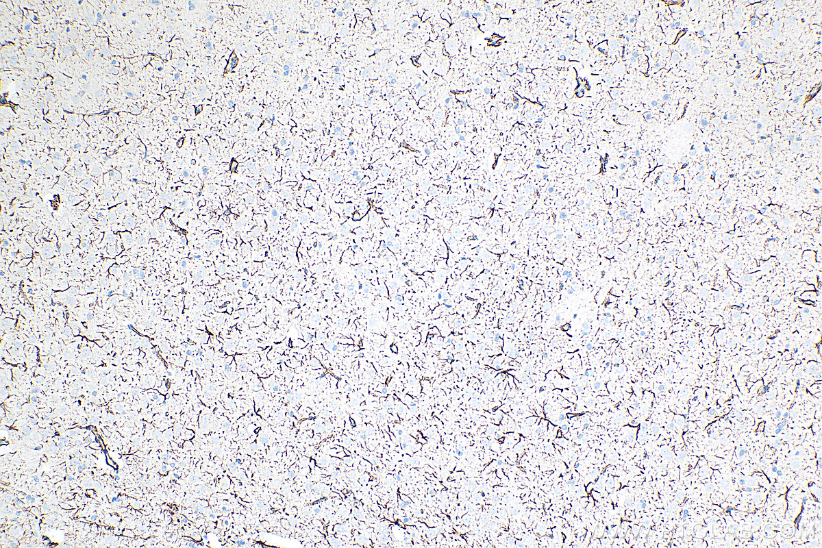 IHC staining of rat brain using 81063-1-RR