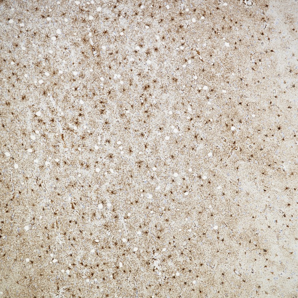 IHC staining of human brain using 81063-1-RR IHC staining of human brain using 81063-1-RR