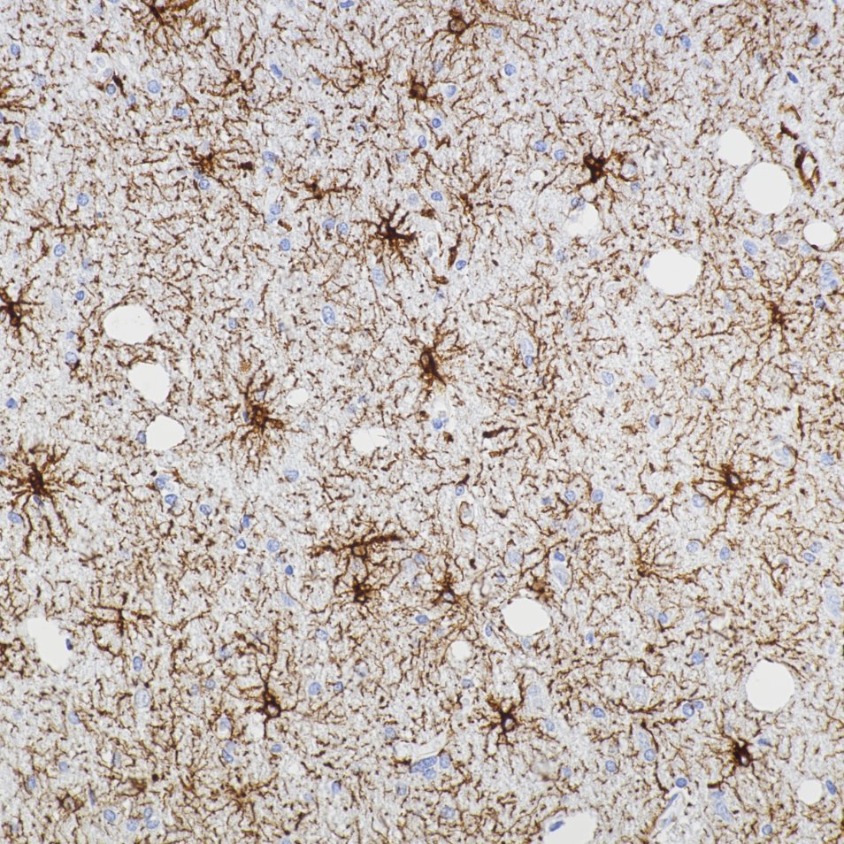 IHC staining of human brain using 81063-1-RR IHC staining of human brain using 81063-1-RR
