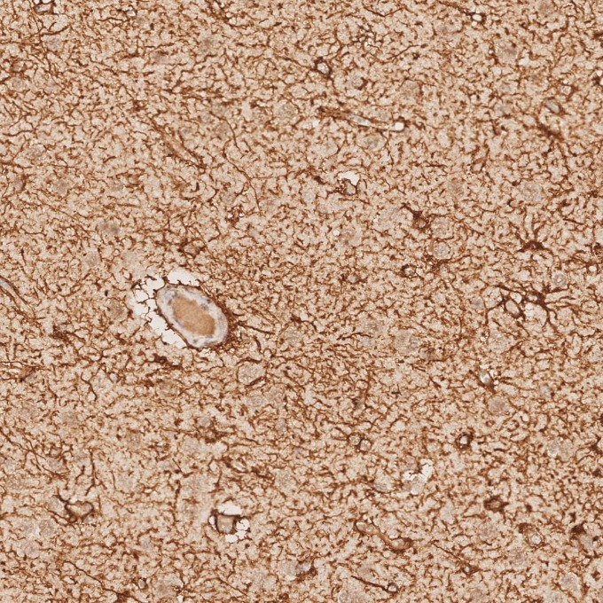 IHC staining of human brain using 81063-1-RR IHC staining of human brain using 81063-1-RR