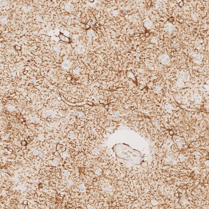 IHC staining of human brain using 81063-1-RR IHC staining of human brain using 81063-1-RR