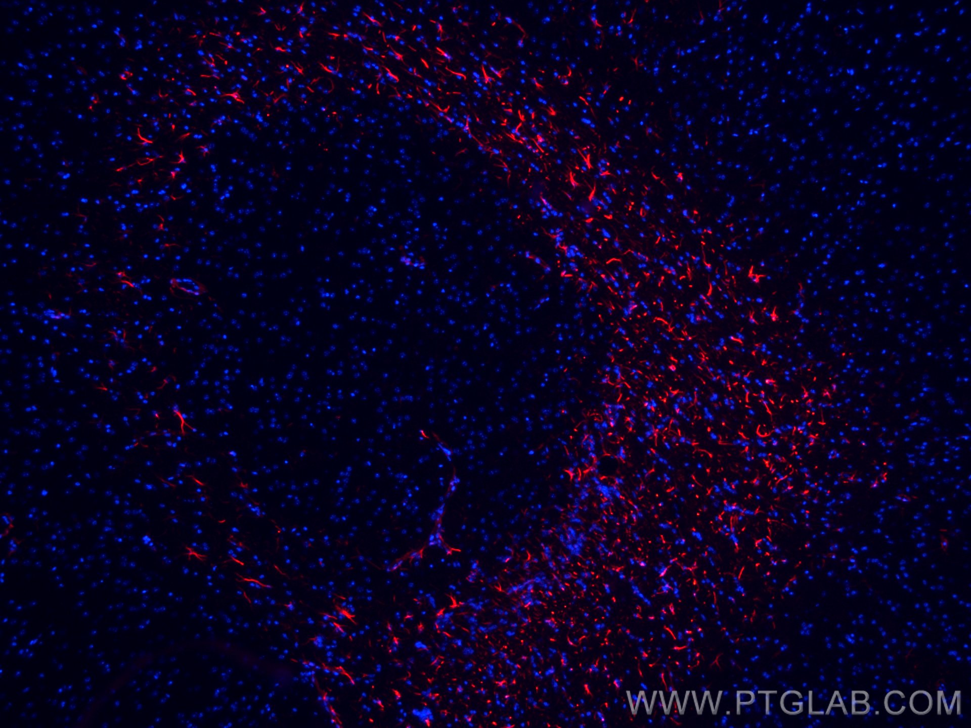 IF Staining of mouse brain using CL594-23935