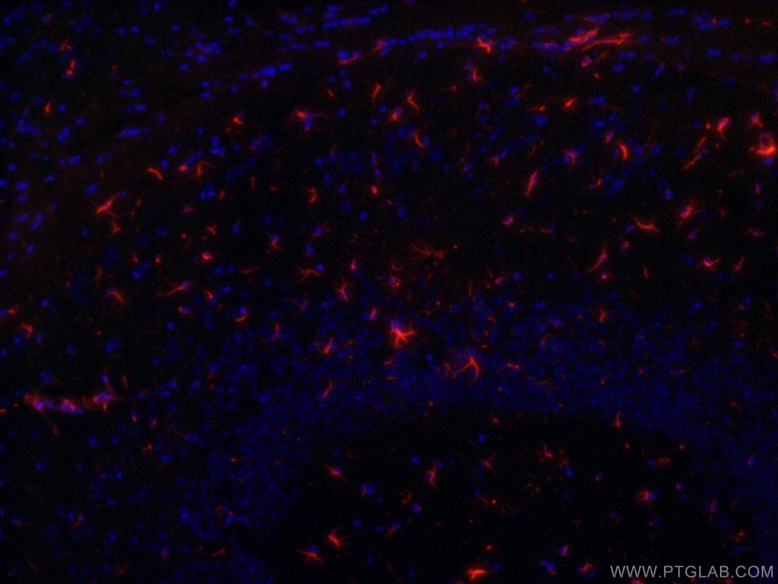 IF Staining of mouse brain using CL594-60190