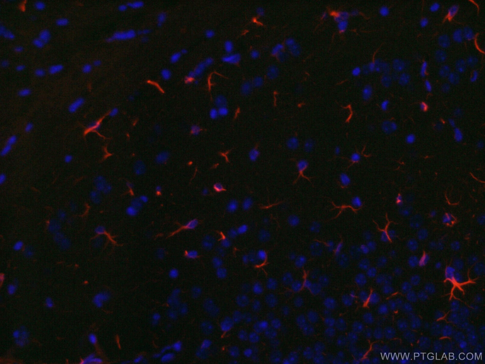 IF Staining of mouse brain using CL594-60190