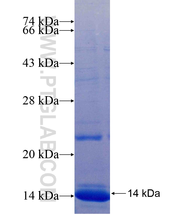GFAP fusion protein Ag17440 SDS-PAGE