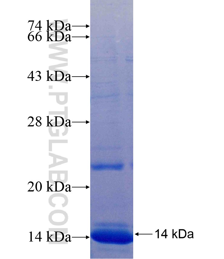GFAP fusion protein Ag17440 SDS-PAGE GFAP fusion protein Ag17440 SDS-PAGE
