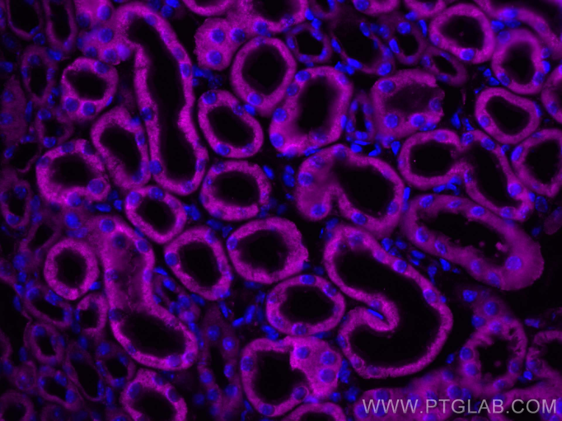 IF Staining of mouse kidney using 11293-1-AP