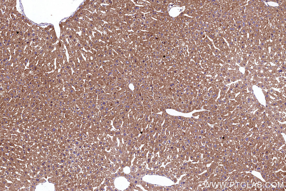 IHC staining of mouse liver using 11293-1-AP IHC staining of mouse liver using 11293-1-AP
