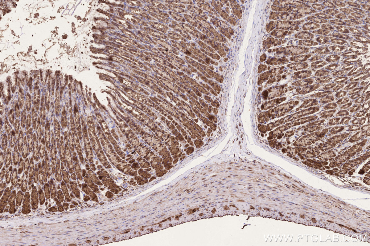 IHC staining of rat stomach using 11293-1-AP IHC staining of rat stomach using 11293-1-AP