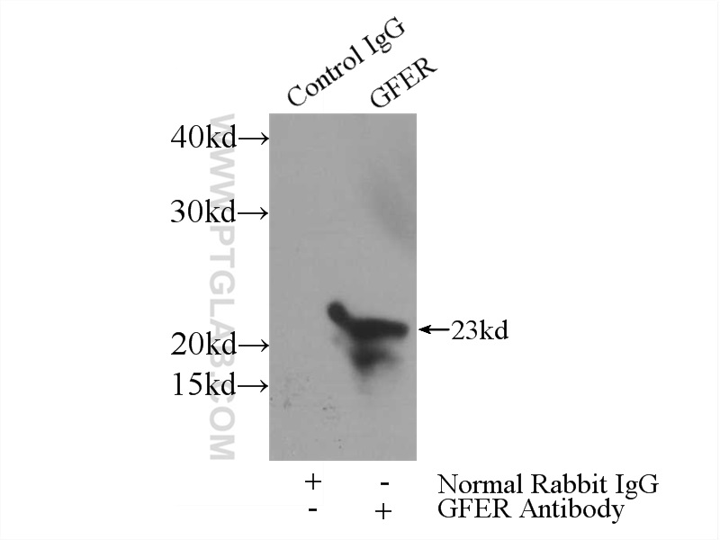 IP experiment of mouse liver using 11293-1-AP