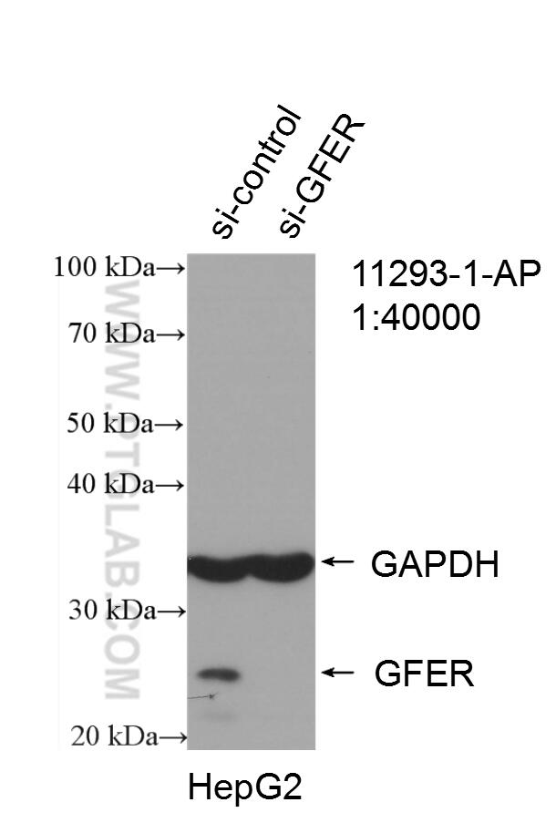 WB analysis of HepG2 using 11293-1-AP (same clone as 11293-1-PBS)