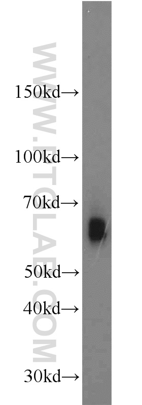 WB analysis of K-562 using 14198-1-AP