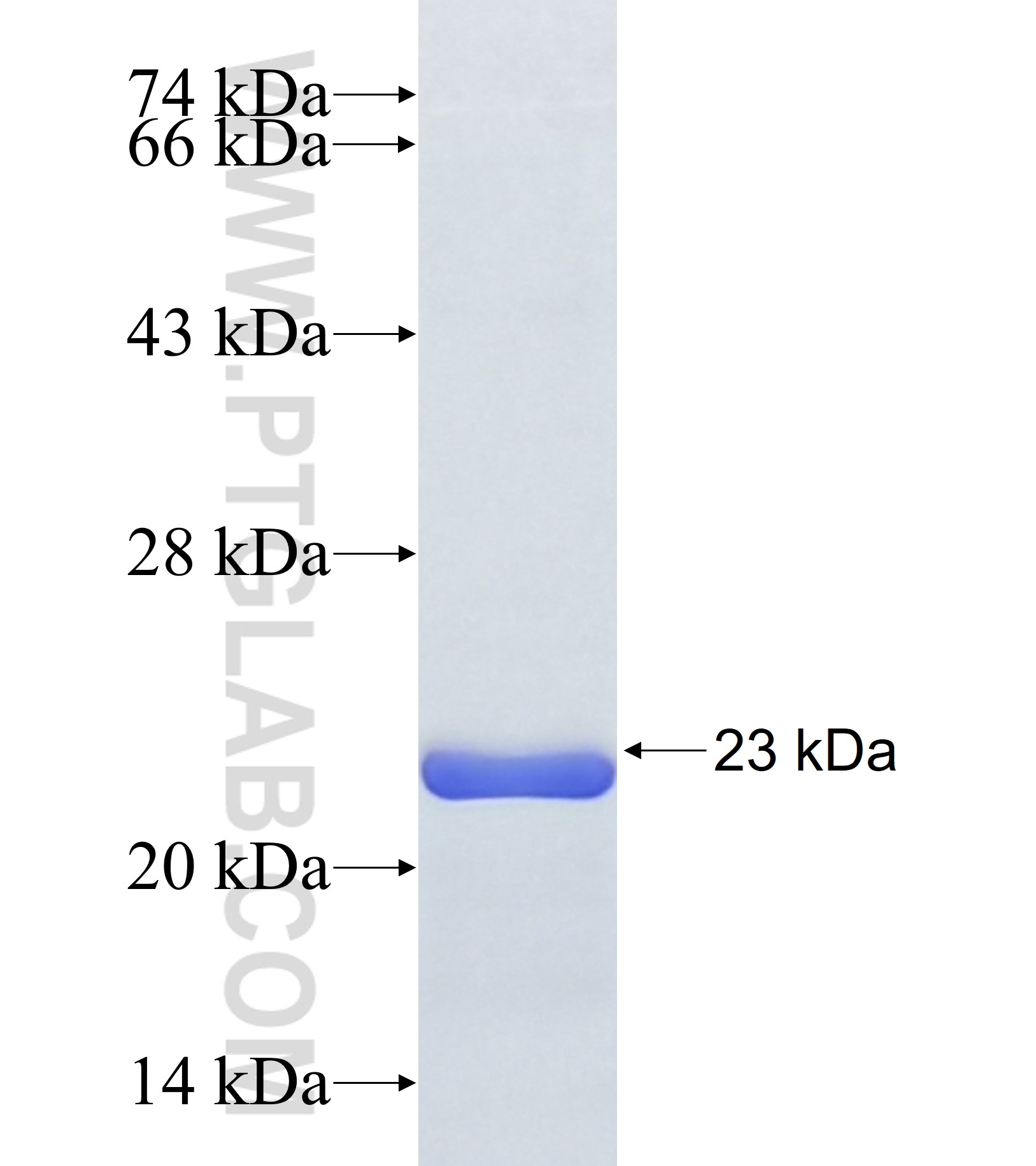 GFI1B fusion protein Ag38112 SDS-PAGE GFI1B fusion protein Ag38112 SDS-PAGE