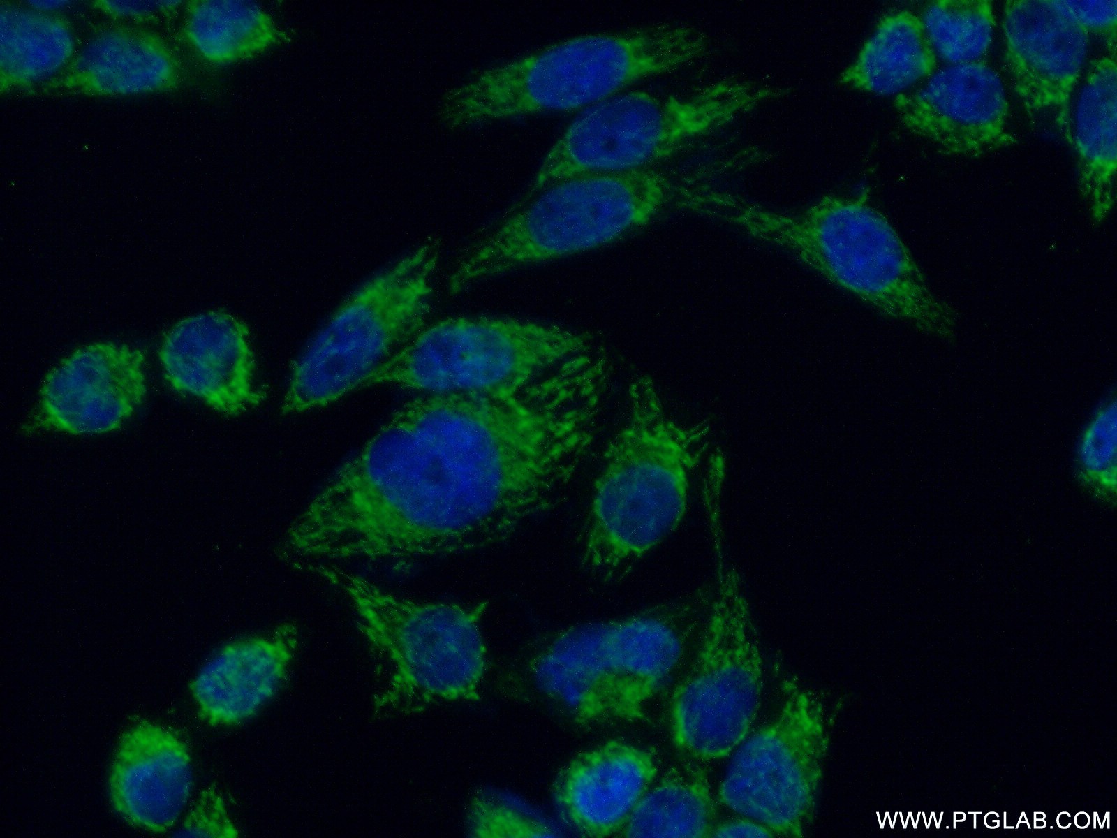 IF Staining of HeLa using 14274-1-AP