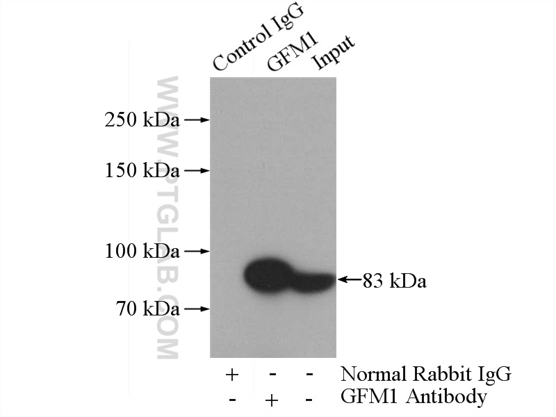 IP experiment of HeLa using 14274-1-AP