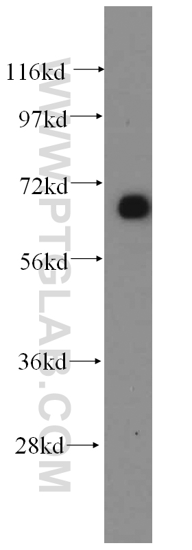 WB analysis of mouse kidney using 14274-1-AP