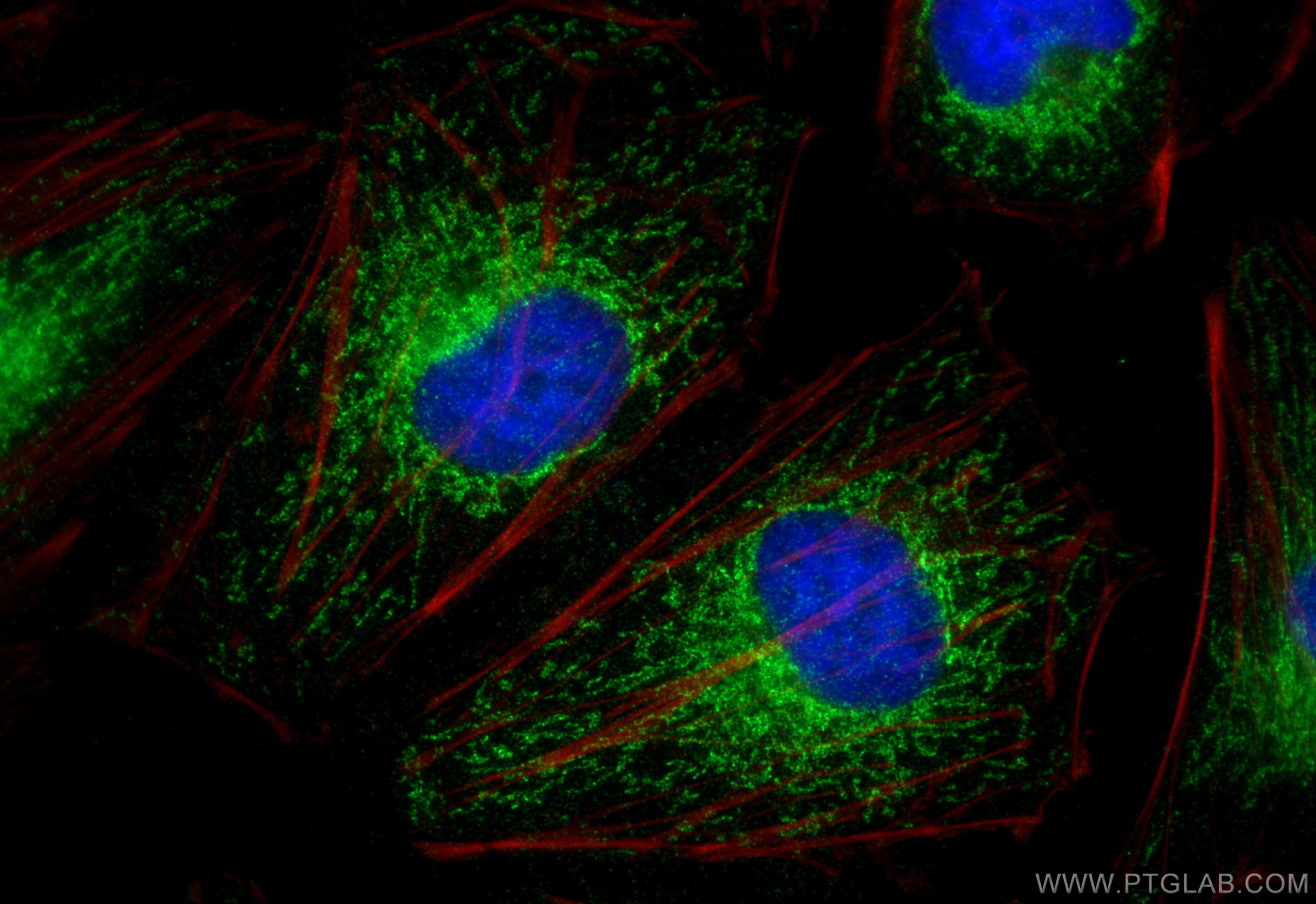 Immunofluorescent analysis of (4% PFA) fixed HeLa cells using GFM2 antibody (16941-1-AP) at dilution of 1:400 and CoraLite®488-Conjugated Goat Anti-Rabbit IgG(H+L) (<a class='green' href='/productredirect?CatalogNo=SA00013-2' target='_blank'>SA00013-2</a>), CL594-phalloidin (red). IF Staining of HeLa using 16941-1-AP