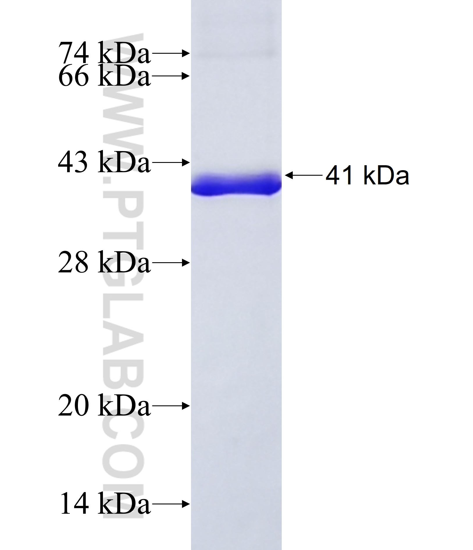 GFM2 fusion protein Ag36976 SDS-PAGE