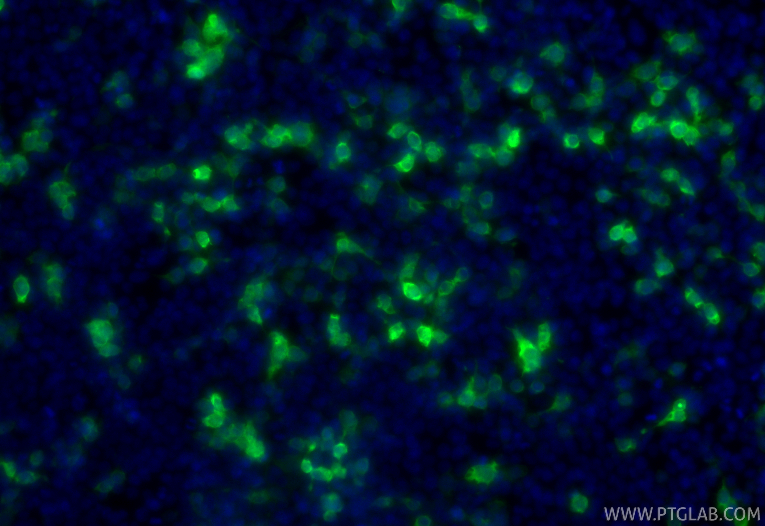 IF Staining of Transfected HEK-293 using CL488-50430 IF Staining of Transfected HEK-293 using CL488-50430