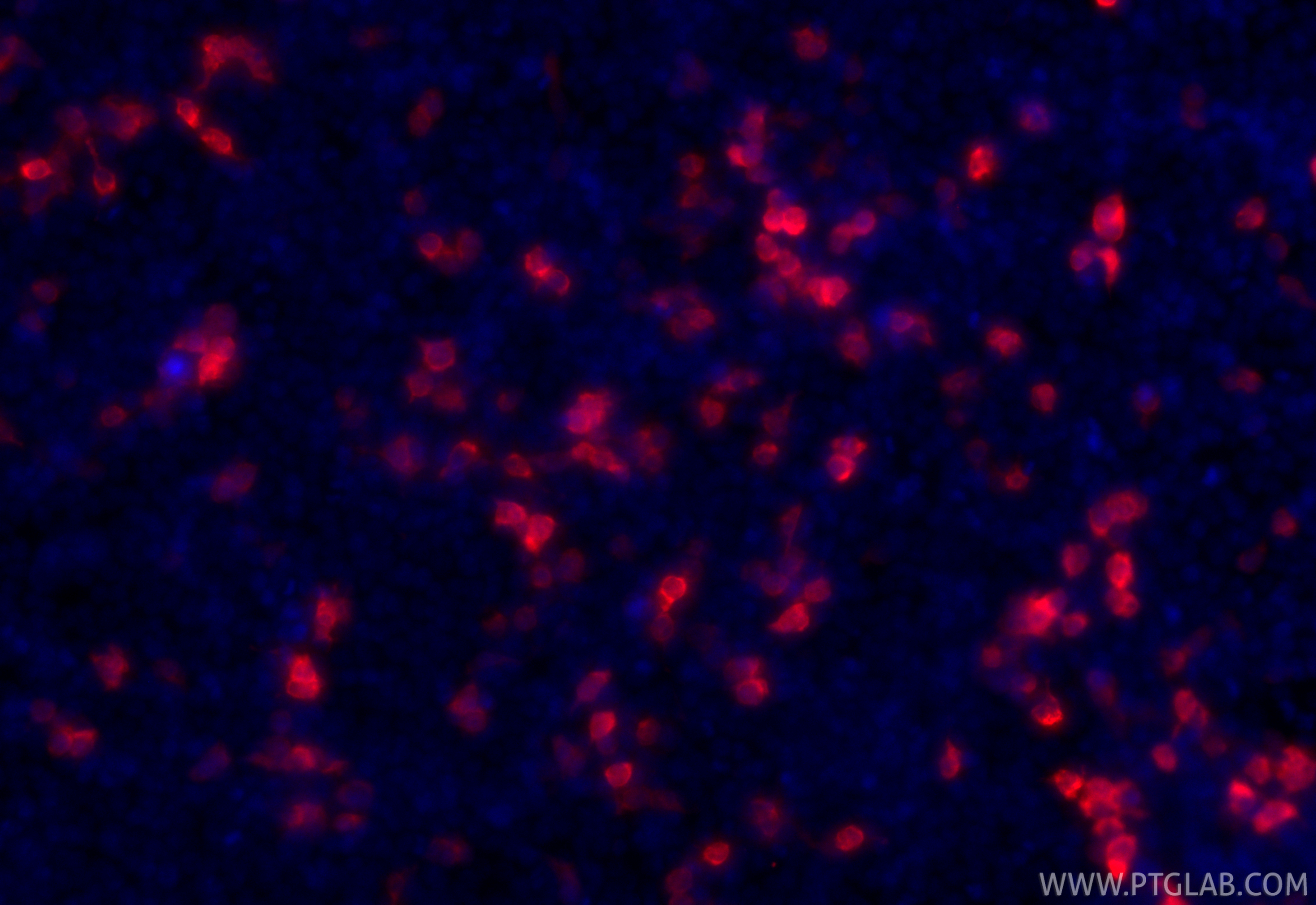 IF Staining of Transfected HEK-293 using CL594-50430