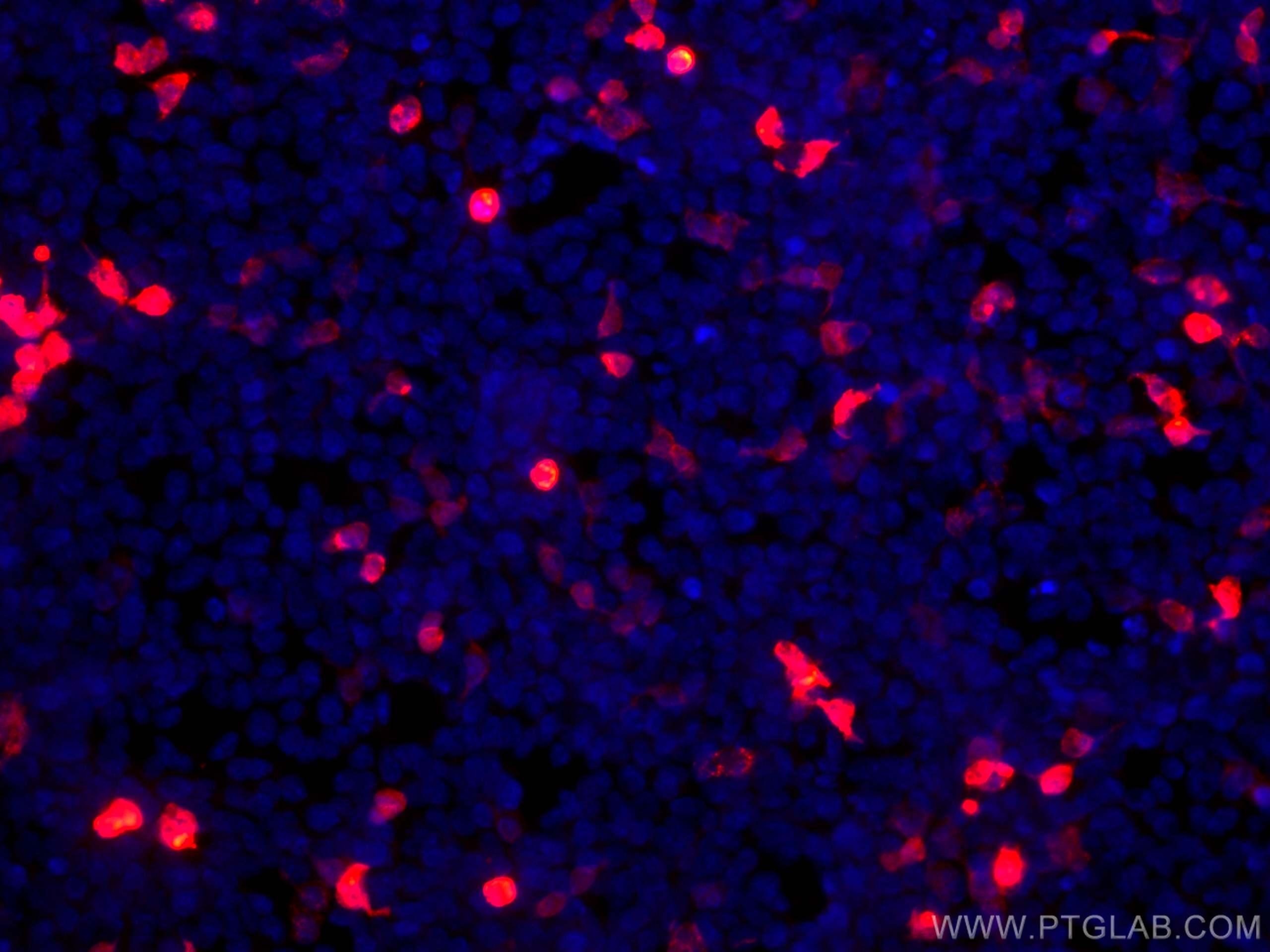 IF Staining of Transfected HEK-293 using CL594-66002