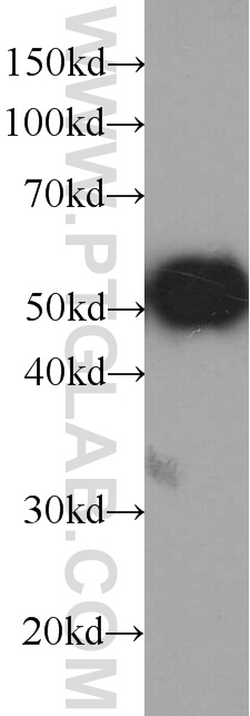 HRP-conjugated GFP tag Monoclonal antibody