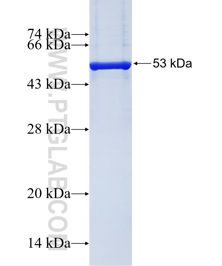 GFP tag fusion protein Ag2128 SDS-PAGE