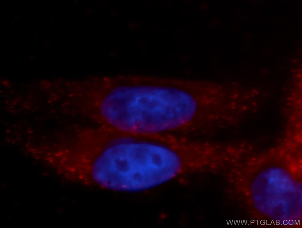 IF Staining of HepG2 using 14132-1-AP