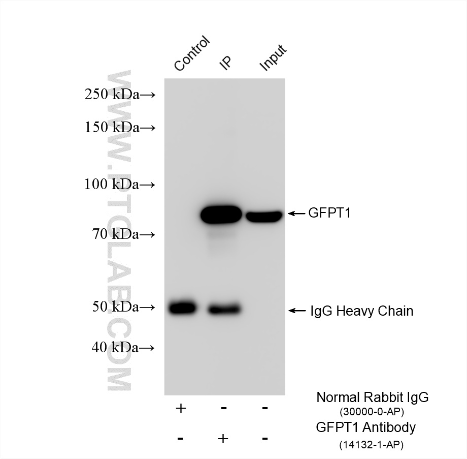IP experiment of HepG2 using 14132-1-AP IP experiment of HepG2 using 14132-1-AP