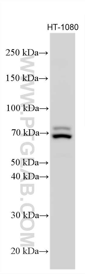 Various lysates were subjected to SDS PAGE followed by western blot with 15189-1-AP (GFPT2 antibody) at dilution of 1:1000 incubated at room temperature for 1.5 hours. WB analysis using 15189-1-AP