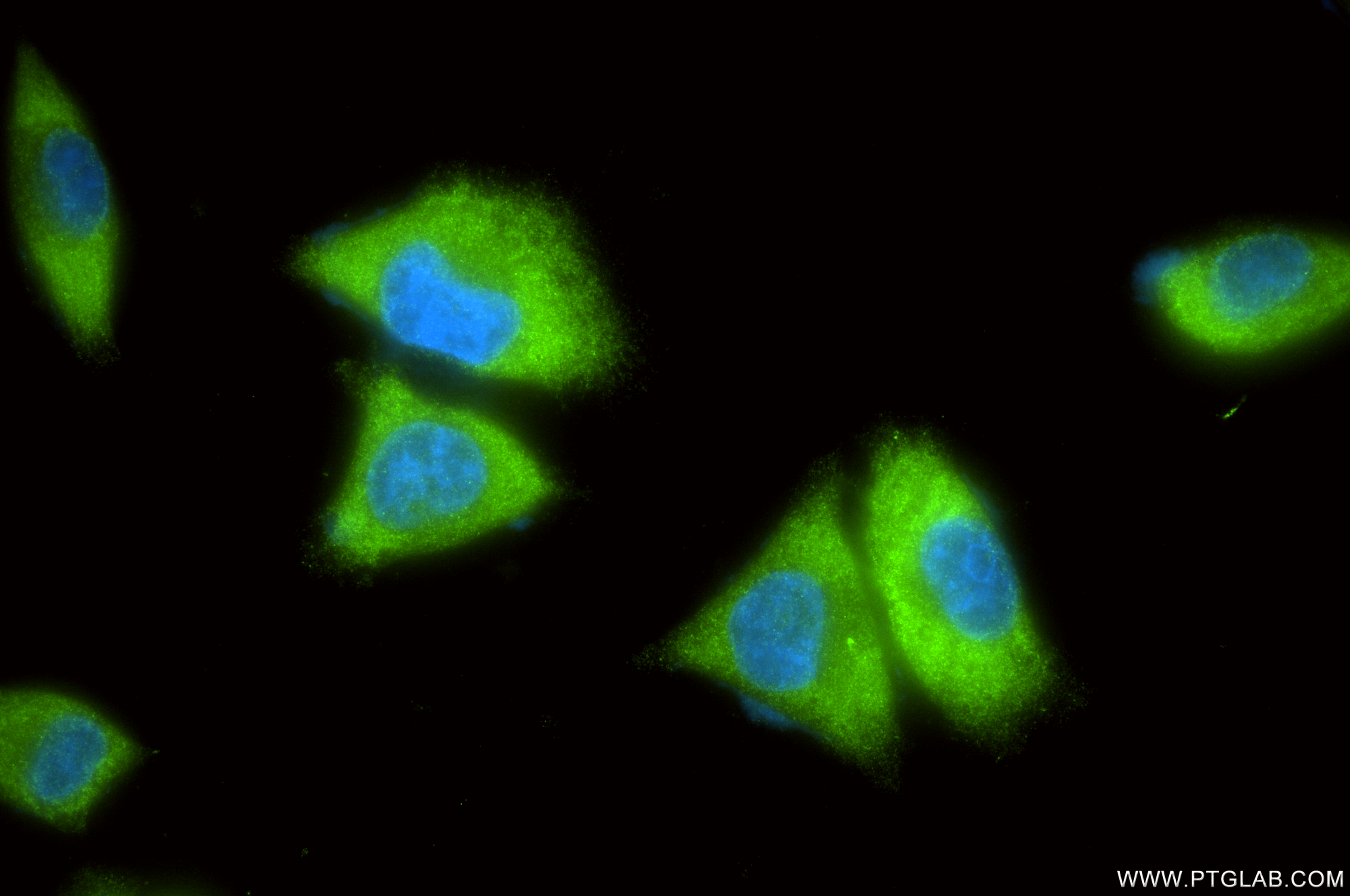 IF Staining of A375 using 86609-3-RR IF Staining of A375 using 86609-3-RR