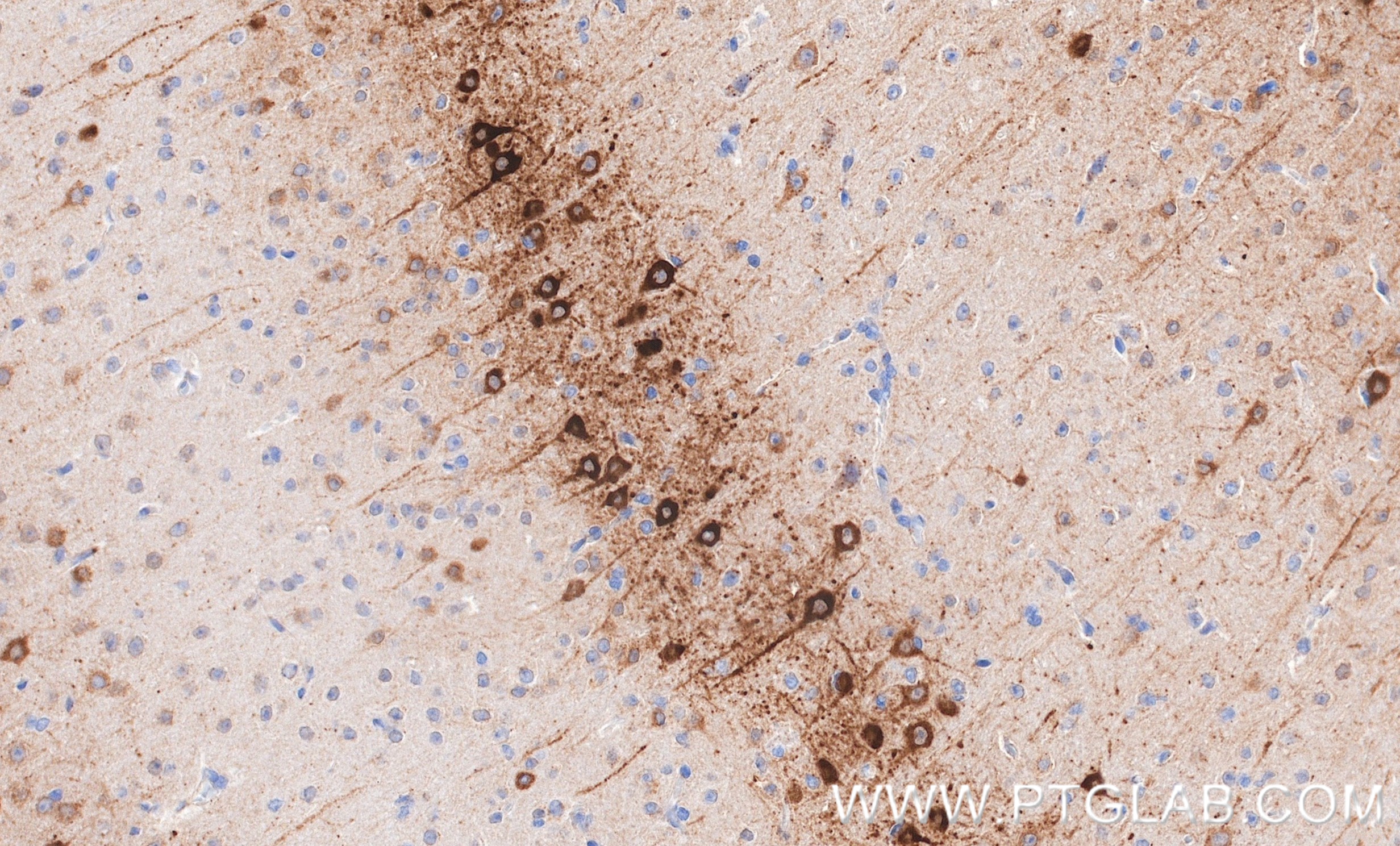 IHC staining of mouse brain using 87383-1-RR (same clone as 87383-1-PBS) IHC staining of mouse brain using 87383-1-RR (same clone as 87383-1-PBS)