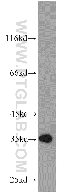 WB analysis of HepG2 using 21973-1-AP