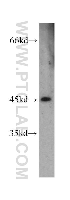 WB analysis of human placenta using 55038-1-AP (same clone as 55038-1-PBS)