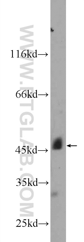 WB analysis of mouse heart using 25379-1-AP