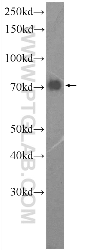 WB analysis of HEK-293 using 25674-1-AP