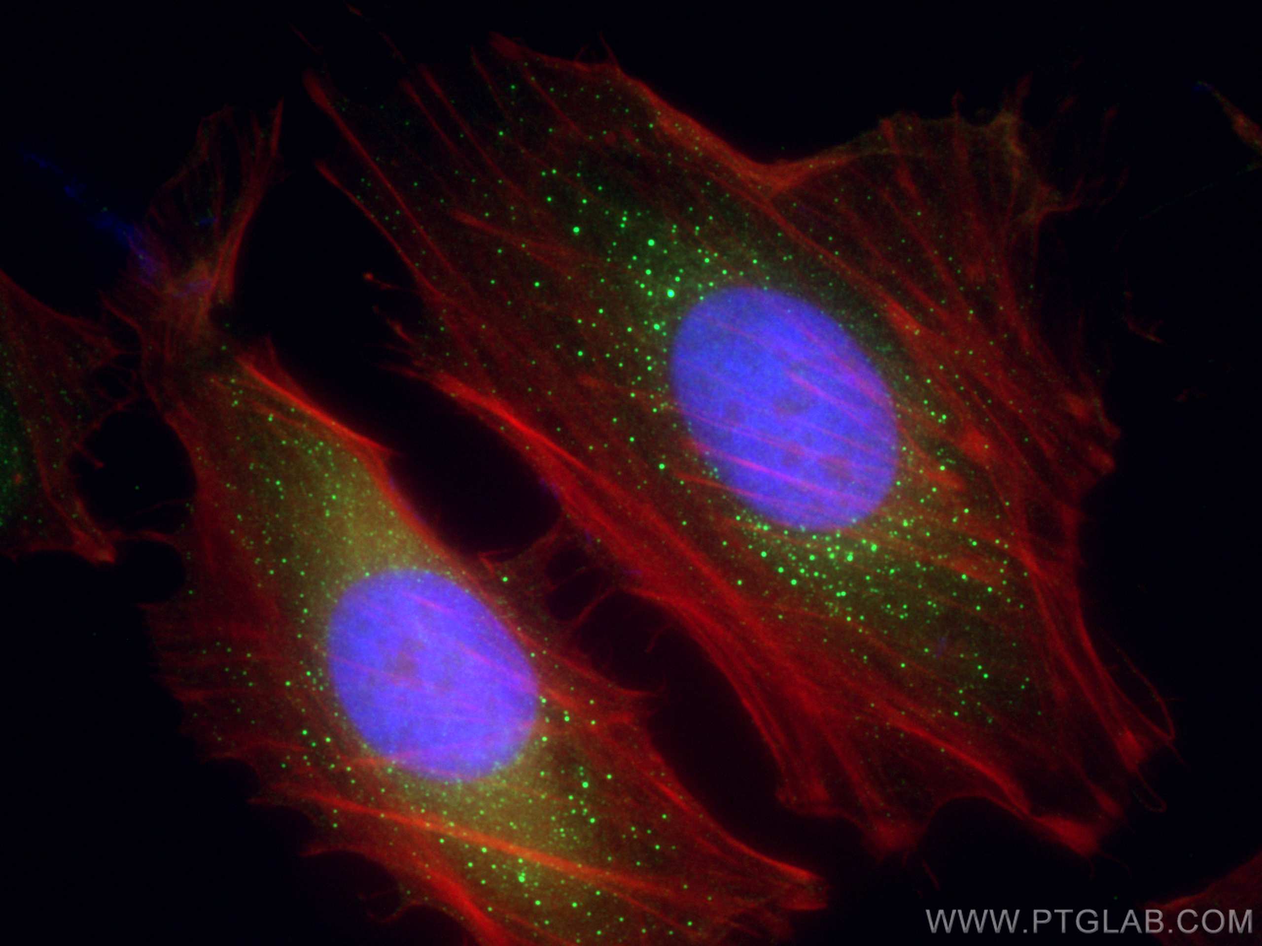 IF Staining of HeLa using 10356-1-AP (same clone as 10356-1-PBS)