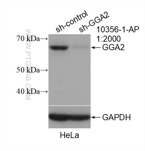 WB analysis of HeLa using 10356-1-AP (same clone as 10356-1-PBS)