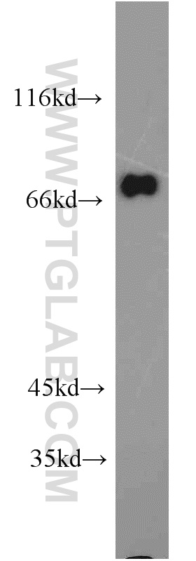 GGA2 Polyclonal antibody