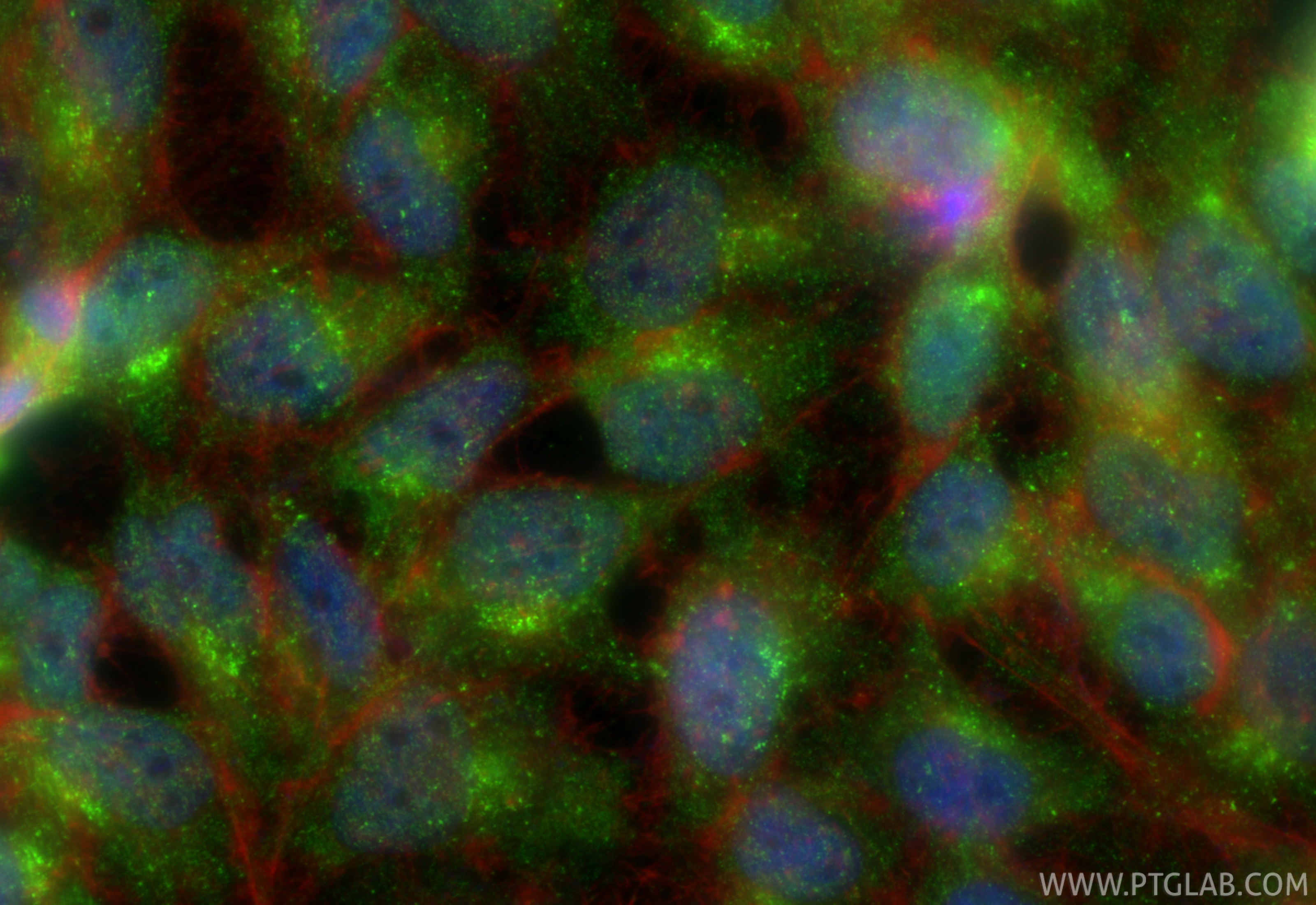 IF Staining of HeLa using 33639-1-AP IF Staining of HeLa using 33639-1-AP