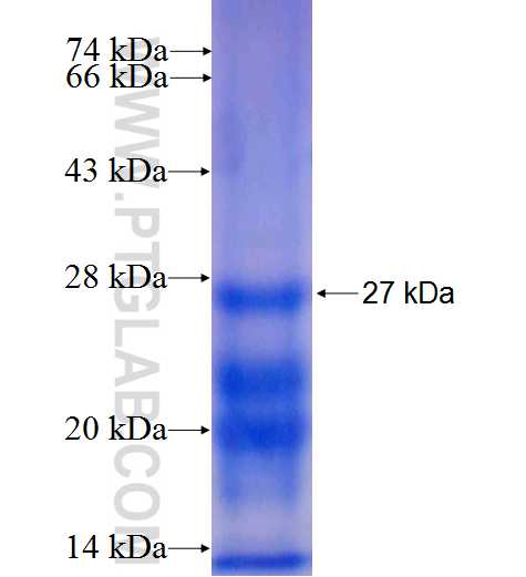 GGCT fusion protein Ag9588 SDS-PAGE GGCT fusion protein Ag9588 SDS-PAGE