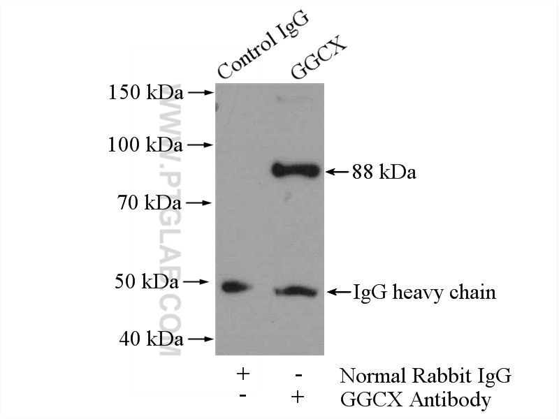 IP experiment of mouse liver using 16209-1-AP