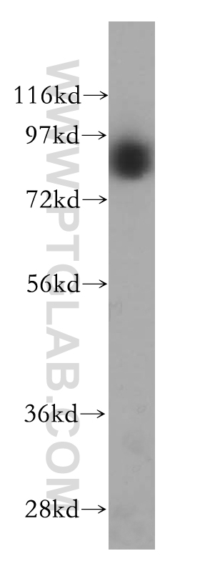 WB analysis of MCF-7 using 16209-1-AP