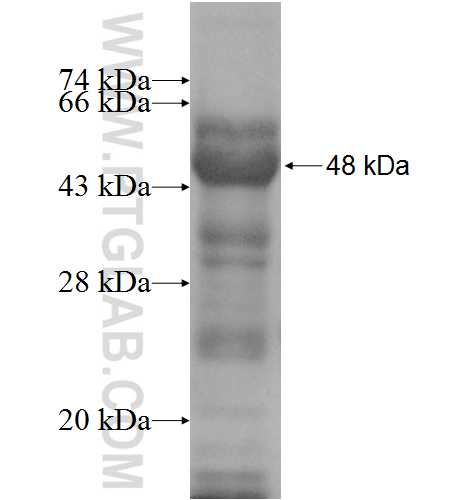 GGCX fusion protein Ag9261 SDS-PAGE